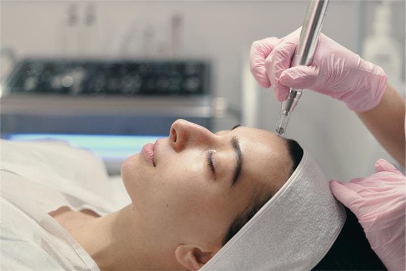 Plasma Skin Resurfacing